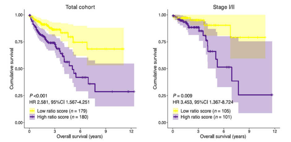  Ravensbergen CJ, Kuruc M, Polack M, et al. The stroma liquid biopsy panel contains a stromal-epithelial gene signature ratio that is associated with the histologic tumor-stroma ratio and predicts survival in colon cancer. Cancers (Basel). 2021;14(1):163.